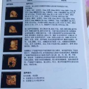 怀孕22周+4天做四维彩超，发现图片上的胎儿头部中间有条缝隙，这是正常的吗,胎儿22周图片欣赏