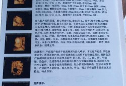 怀孕22周+4天做四维彩超，发现图片上的胎儿头部中间有条缝隙，这是正常的吗,胎儿22周图片欣赏
