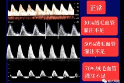 B超单显示单脐动脉是怎么回事,胎儿只有一条脐动脉正常吗