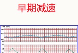 胎儿胎心过慢是什么原因,胎儿胎心减慢,在正常范围