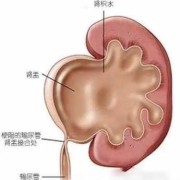 小孩腹腔积液是怎么回事,胎儿腹腔积液产生的原因有三