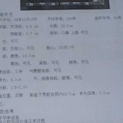 孕期糖筛时间（怀孕多少周妊娠糖尿病啊？孕8个月多了，查了血糖有些高）