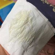 怀孕期间白带异常（怀孕期间白带不正常）