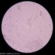孕期尿有细菌（孕期尿有细菌是怎么回事）