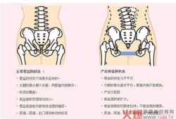 胎儿出骨盆（孕妇盆骨变化是怎样的）