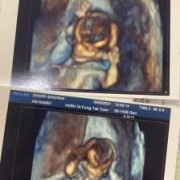 怀孕13周胎儿图片欣赏（怀孕13周胎儿图片欣赏视频）