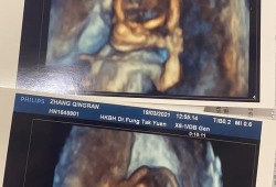 怀孕13周胎儿图片欣赏（怀孕13周胎儿图片欣赏视频）