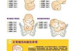 胎儿x单体（胎儿x单体的原因）
