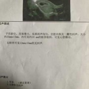 宫腔内囊性回声什么意思,胎儿右下腹囊性回声严重吗