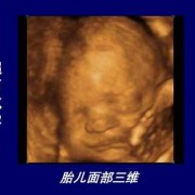 什么是三维,三维胎儿图片和出生像吗