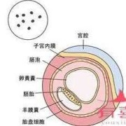 妊娠空囊是怎么回事,胎儿是空囊是什么意思