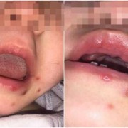 爸爸可以亲婴儿的嘴巴吗,胎儿嘴发育好以后还会出现问题吗