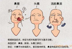 怀孕鼻炎犯了影响胎儿（怀孕鼻炎犯了影响胎儿吗）