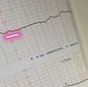 胎儿胎心在140以下这样算正常吗,胎儿胎心率低是什么原因