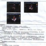 心脏超声检查多少钱,胎儿心脏筛查多少钱一次