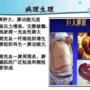 胎儿脾肿大（胎儿脾肿大的原因和危害）