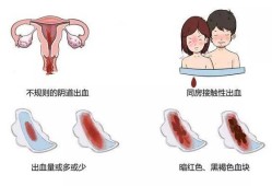 怀孕期间阴道出血（怀孕期间出血是什么情况）