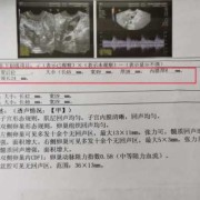 请问怀孕之后子宫会不会增大啊?子宫增大的速度超过胎龄是否不正常啊,易孕期会不会怀孕吃了药