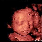 宝宝总皱眉怎么回事,胎儿皱眉头的四维