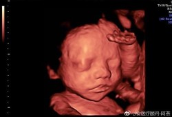 宝宝总皱眉怎么回事,胎儿皱眉头的四维