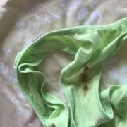怀孕了白带变绿色是什么原因,