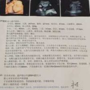 双肾皮质回声增强怎么回事,胎儿双肾皮质回声增强是怎么回事