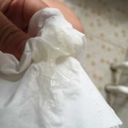 孕期白带少正常吗（孕期白带少正常吗）