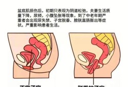 孕期盆底肌（孕期盆底肌）
