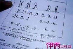胎儿染色体是检查什么（胎儿染色体是检查什么的?）