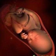 怀孕四个月孩子股骨弯曲成角怎么办呢,怀孕三个半月胎儿图片视频