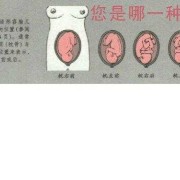 三十二周胎儿发育情况（孕32周胎位LOT是什么意思？可以给孕妇吃什么东西）
