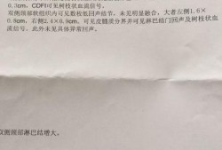 胎儿颈部见w形压迹是什么意思（b超显示颈部有u型压迹是什么意思）