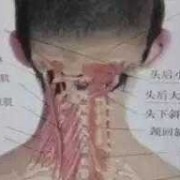 胎儿后脑增宽（胎儿后脑增宽的原因是什么）