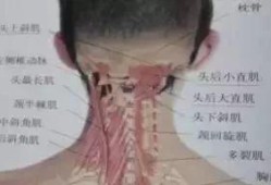 胎儿后脑增宽（胎儿后脑增宽的原因是什么）