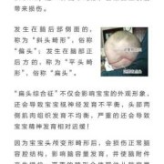 睡平头正确方法,胎儿头朝左是男孩女孩