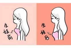 孕期乳房变大（孕期乳房变大生完孩子会缩小么）