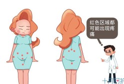 孕期阴道口疼（孕期下体偶尔一阵轻微刺痛）