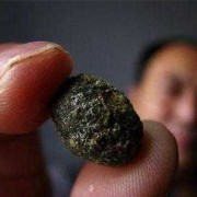 孕期胆囊结石（孕期胆囊结石）