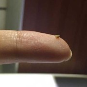 孕期乳头有白色颗粒（为什么孕期乳头有白色颗粒）