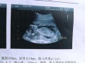 孕十七周胎儿有多大,孕17周胎儿多大图片