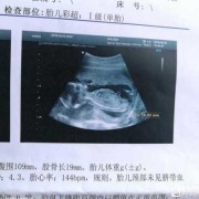 孕十七周胎儿有多大,孕17周胎儿多大图片
