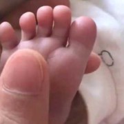 胎儿为什么会手掌缺如（宝宝手心脚心发烫是咋回事）