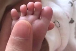 胎儿为什么会手掌缺如（宝宝手心脚心发烫是咋回事）