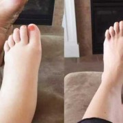 孕妇下肢浮肿的原因，孕期小腿浮肿怎么办,孕期脸浮肿是什么原因引起的