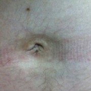 孕期肚脐周围凹进去（孕期肚脐周围凹进去的是男孩女孩）