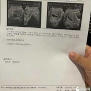怀孕期鉴别孩子（怀孕期鉴别孩子）
