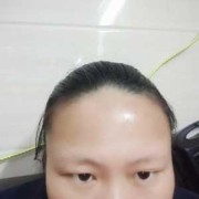 孕期后变黑（孕期脸变黑了是怎么回事）