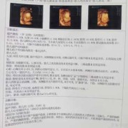 胎儿偏小有什么影响吗（胎儿偏小有什么影响吗女性）