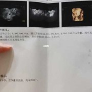 胎儿六周（胎儿六周有胎心吗）