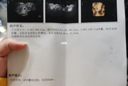 胎儿六周（胎儿六周有胎心吗）